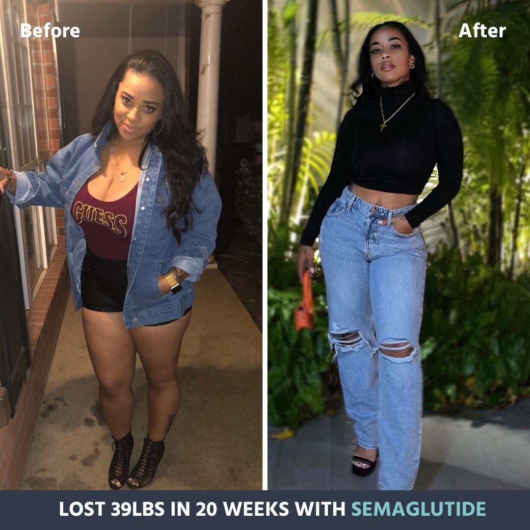semaglutide success stories and Tirzepatide in Clinical Practice: Real-Life Woman shares journey of weight